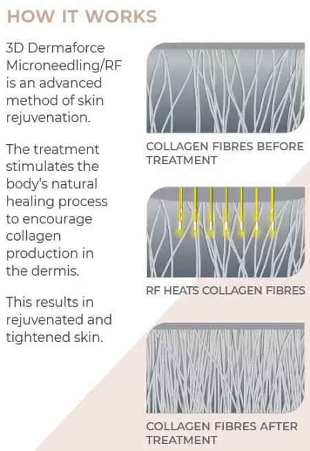 Dermaforce how it works